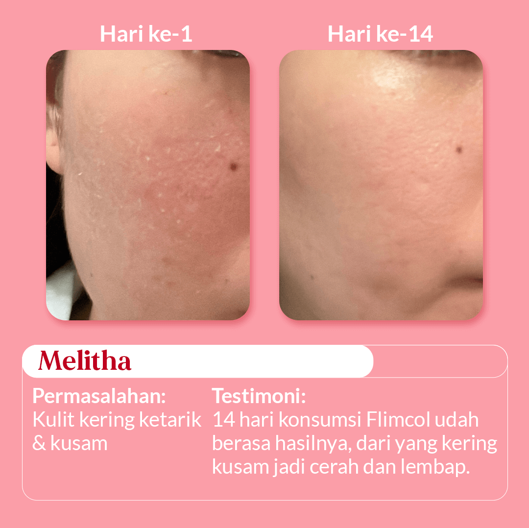 Landing-Page_4_2 (1)