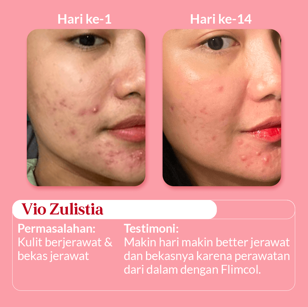 Landing-Page_4_3 (1)