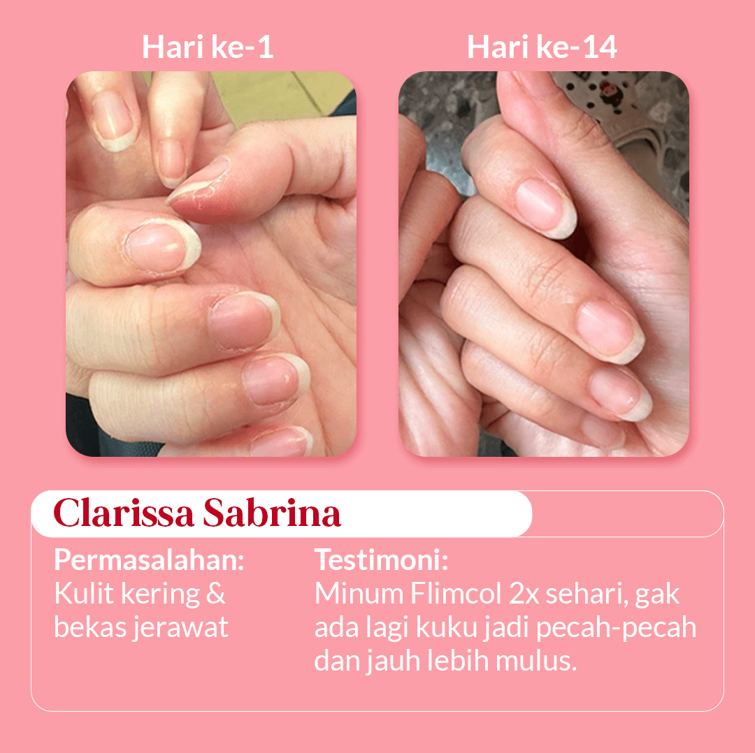 Landing-Page_4_5 (1)